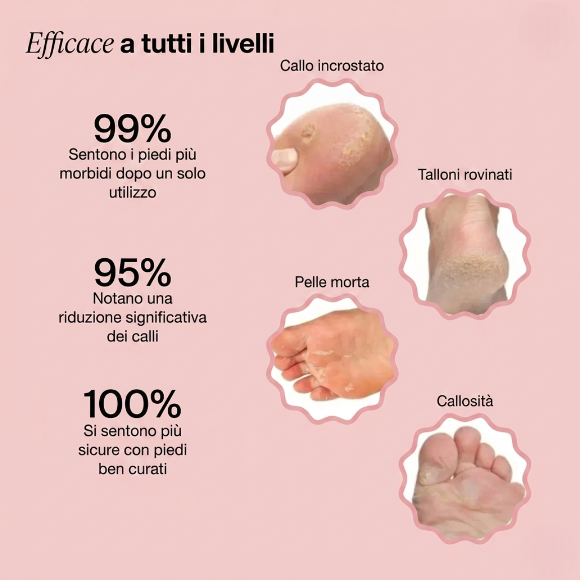 Glorya™ Levigatrice Elettrica per i Piedi