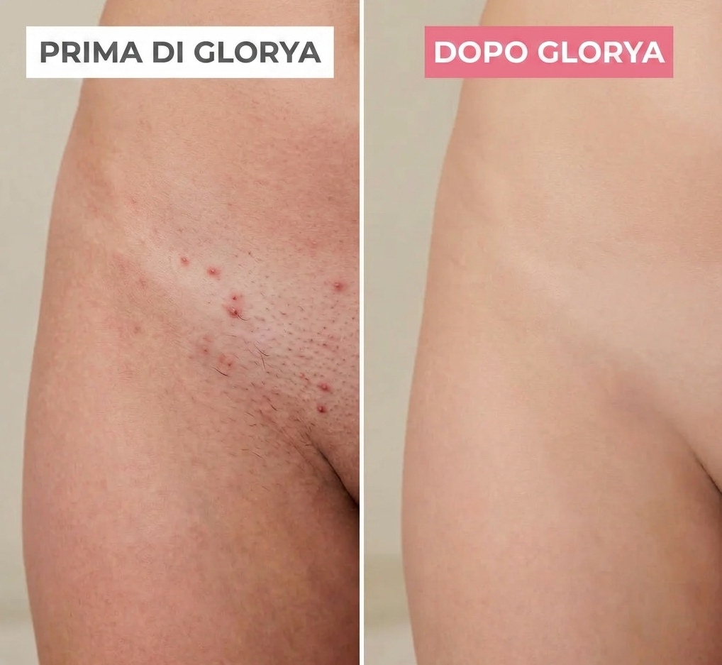 Glorya - Rasoio 2 in 1